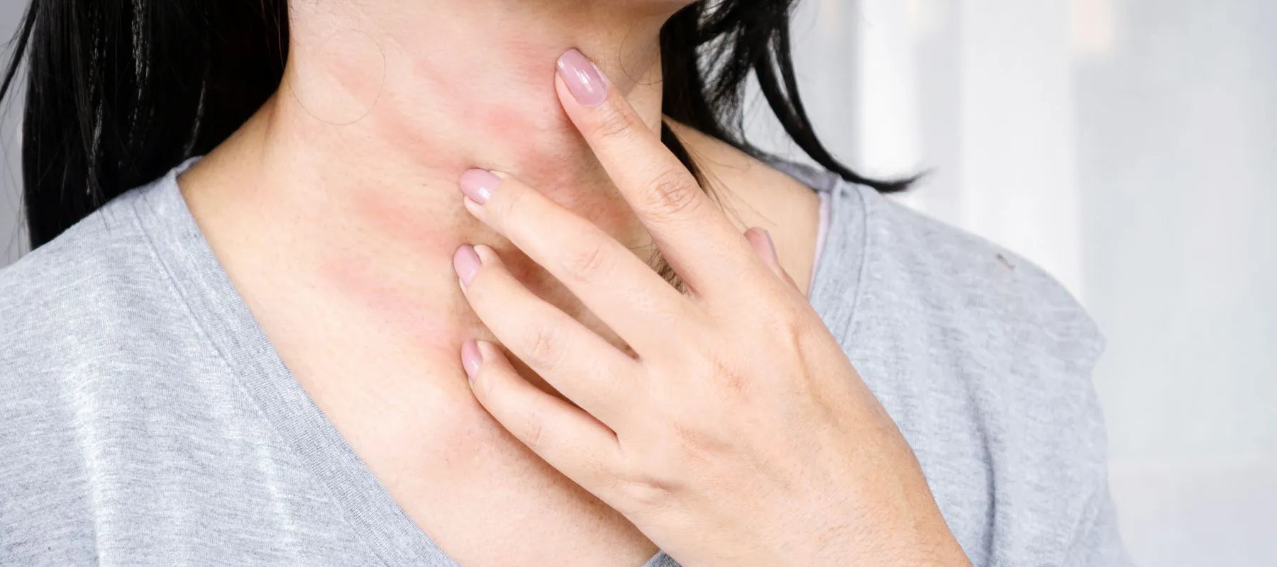 Itchy Bumps on Skin: Causes and Treatment | The Pink Foundry