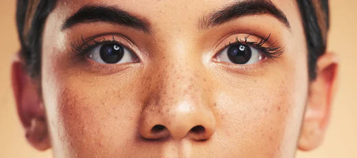 How to treat melasma on face